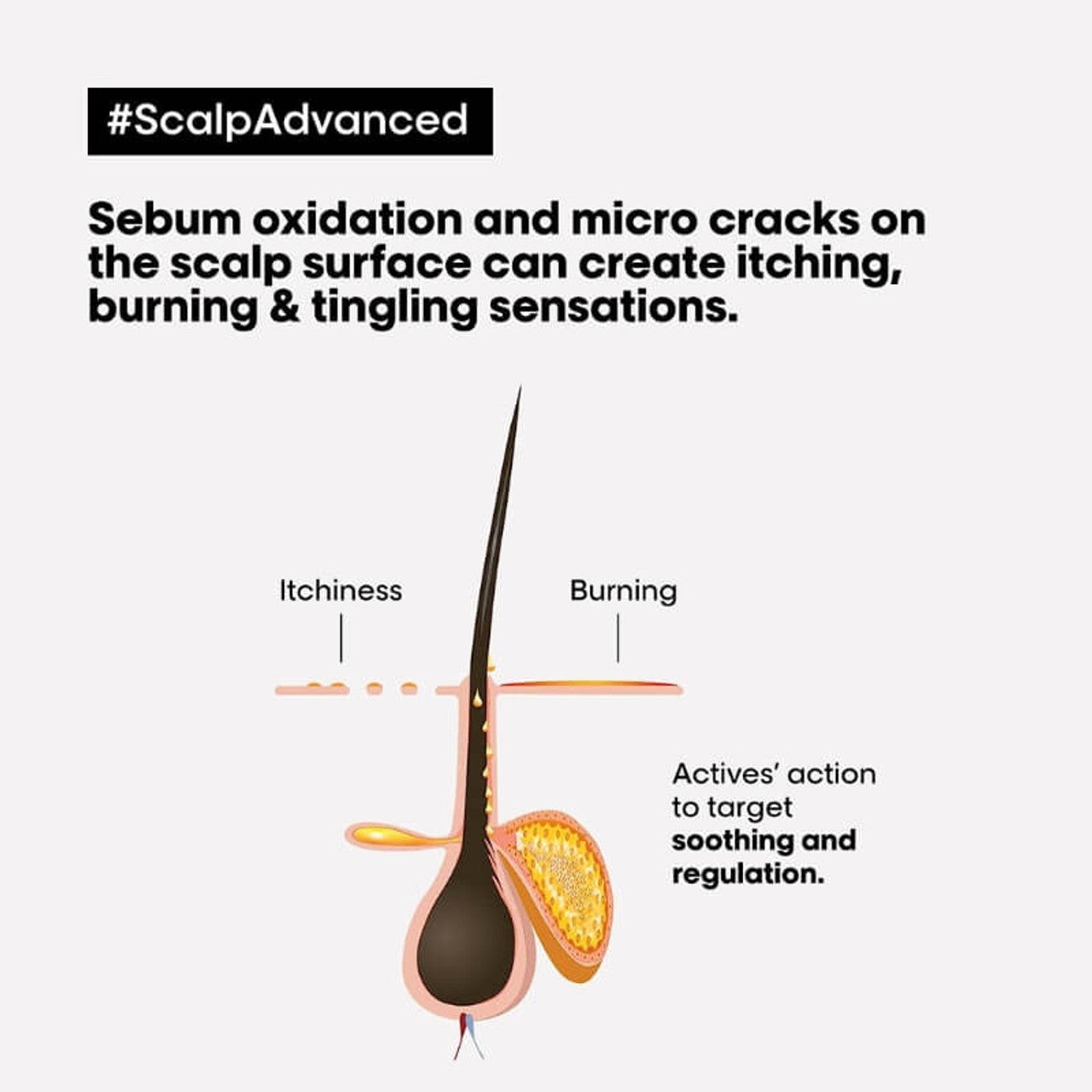 L'Oréal Professionnel Série Expert Scalp Advanced Anti-Discomfort Dermo-Regulator Shampoo 300ml